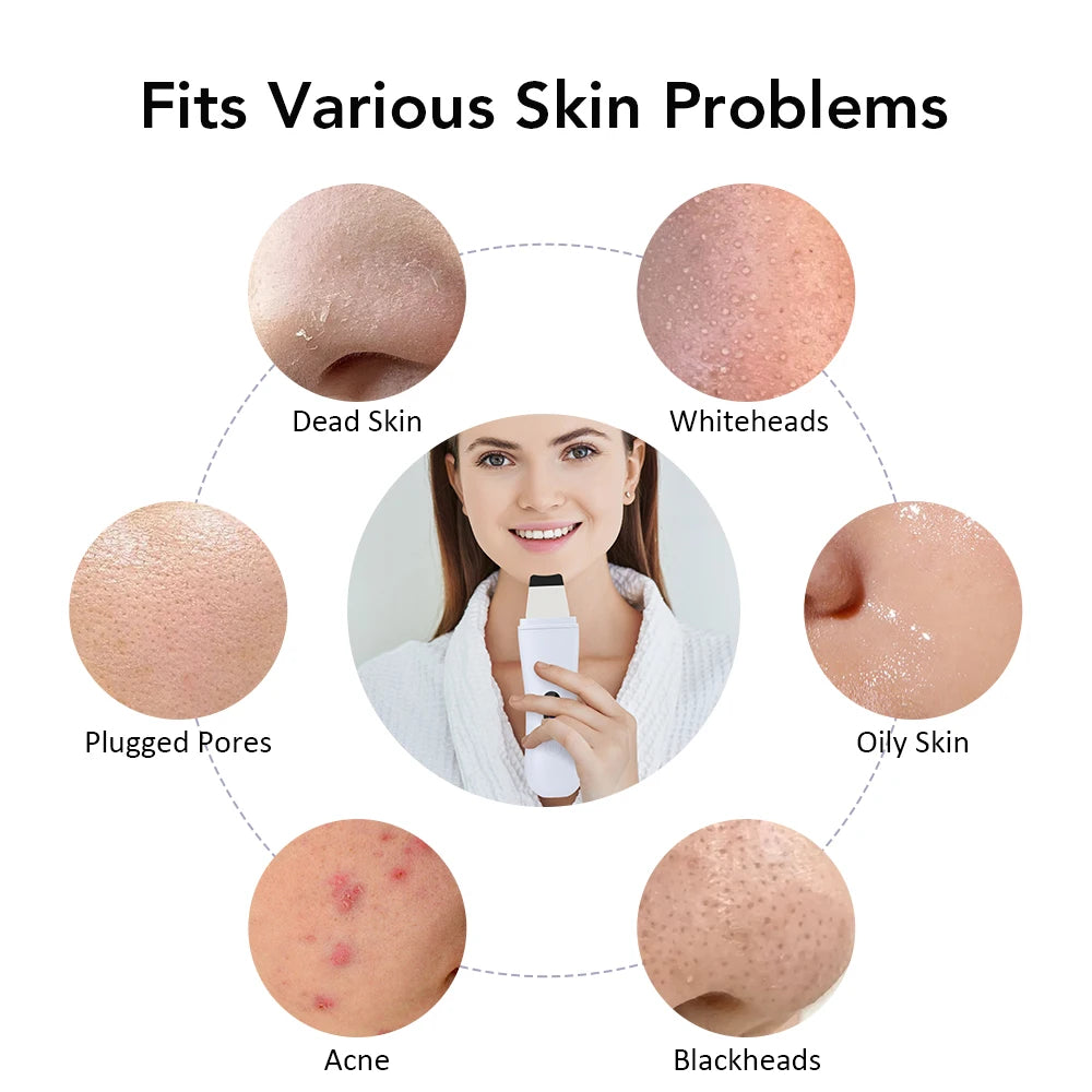 Espátula Facial Ultrassônica com Lifting 4 em 1